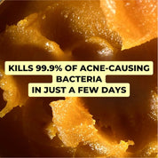 Complete Anti-Acne Ritual – Clear, Blemish-Free Skin