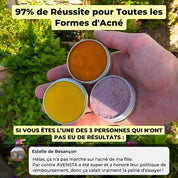 Rituel Complet Anti-Acné - Peau Nette & Confiance Retrouvée