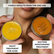 Complete Anti-Acne Ritual – Clear, Blemish-Free Skin